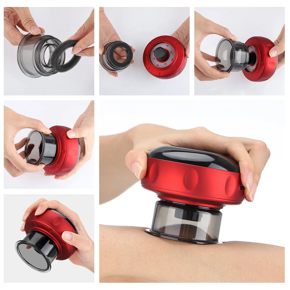 Electronic Cupping Device