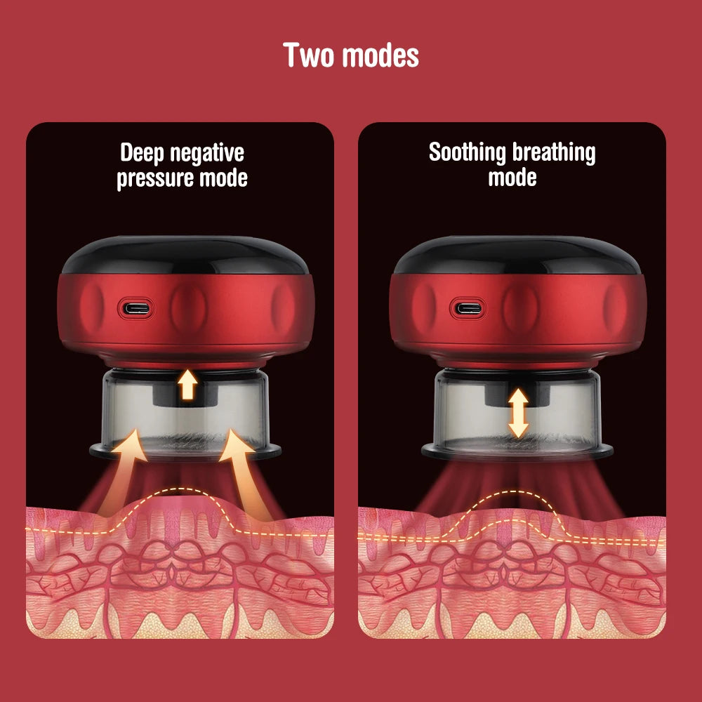 Electronic Cupping Device