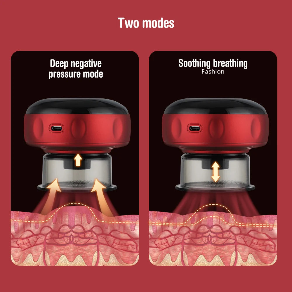 Electronic Cupping Device